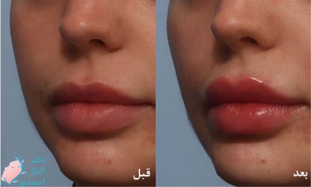 تلاش برای رسیدن به حجم دلخواه شما