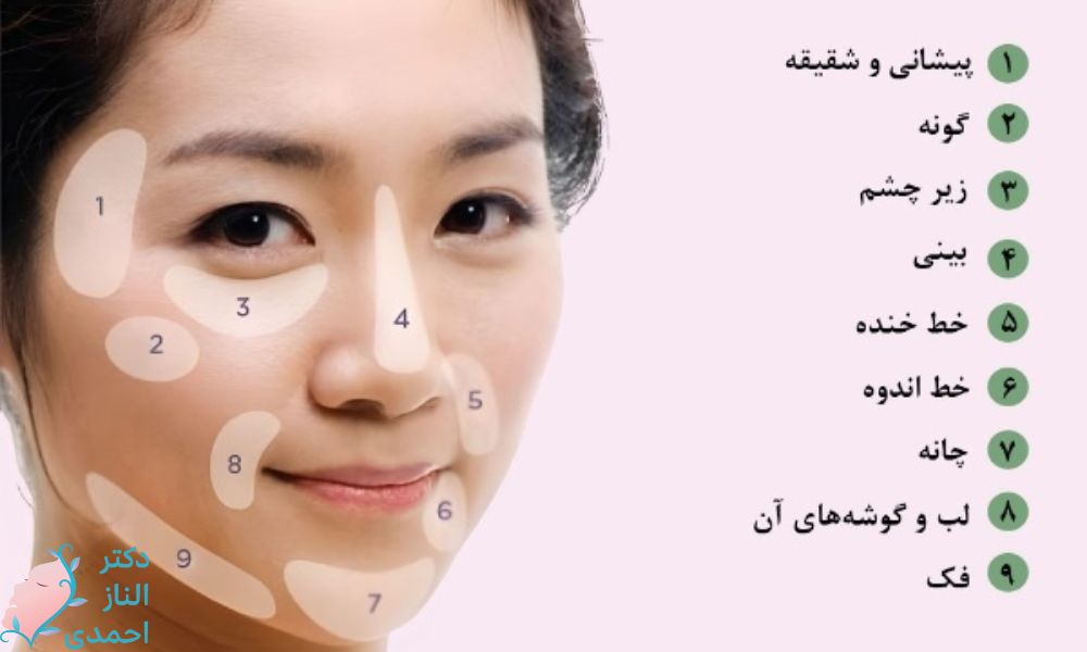 میزان ژل یا فیلر مورد نیاز به تفکیک محل تزریق