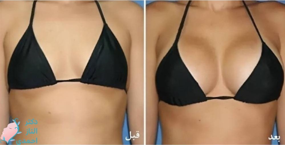 سینه