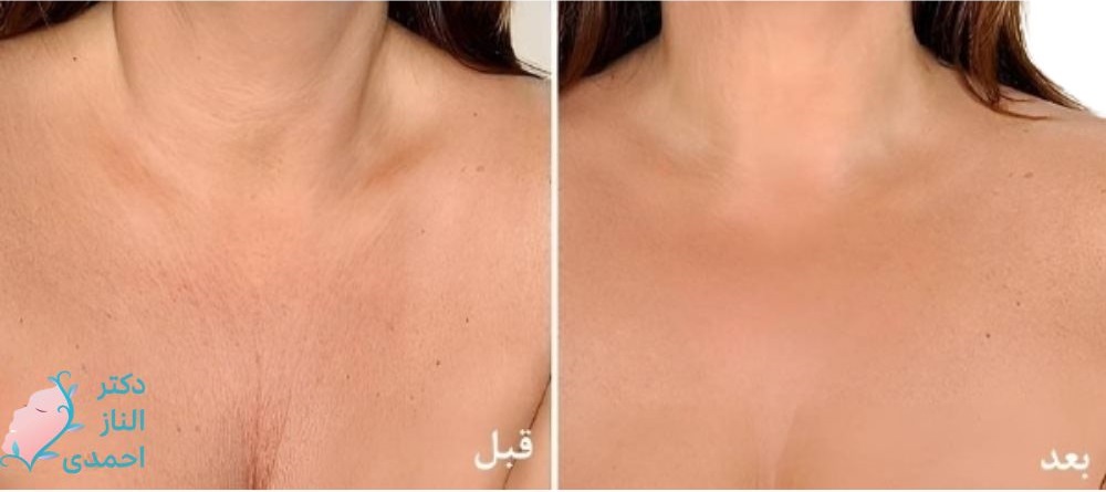 ناحیۀ دکلته