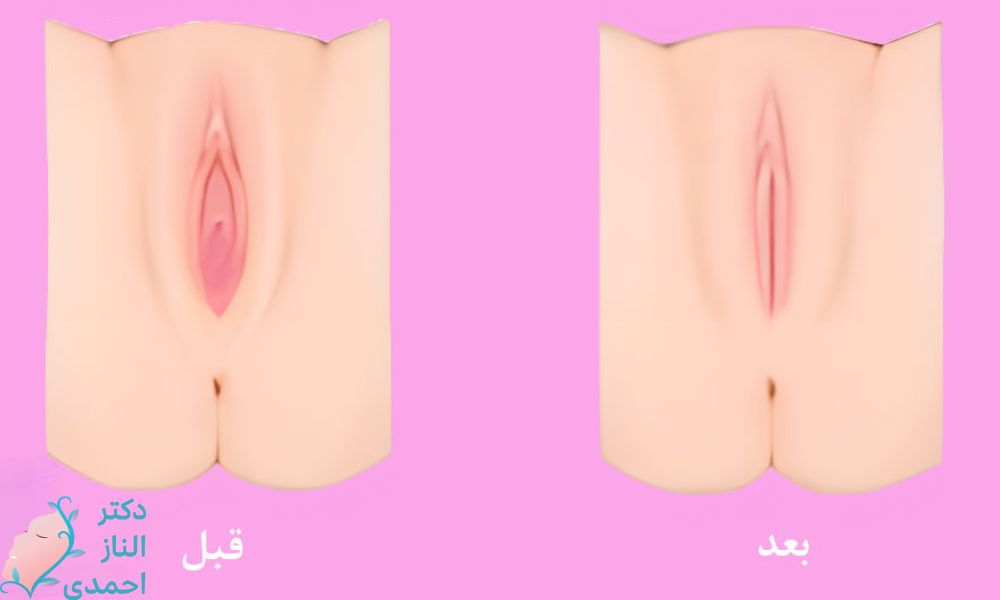 لابیا ماژور