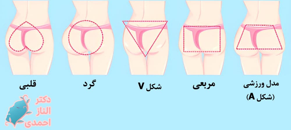 مزایای تزریق ژل باسن 