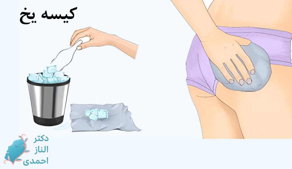 مراقبت‌های پس از تزریق ژل 