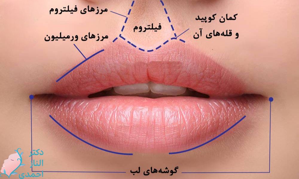 لب زیبا و طبیعی چگونه است؟