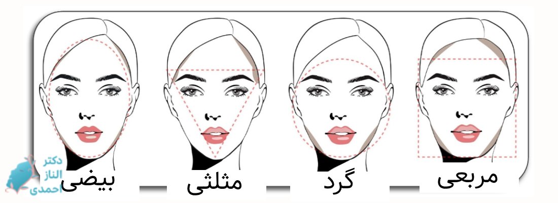 کدام مدل تزریق ژل لب برای کدام مدل صورت طبیعی است