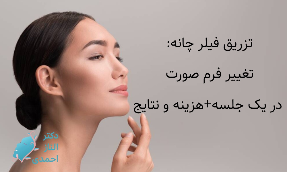 تزریق فیلر چانه: تغییر فرم صورت در یک جلسه+هزینه و نتایج