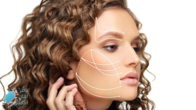 نخ کلاژن جذبی بدون تزریق و تفاوت آن با لیفت با نخ + روش انجام
