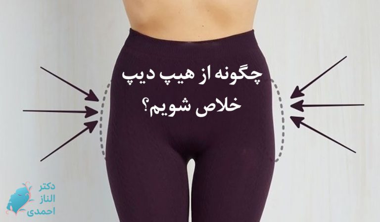 هیپ دیپ
