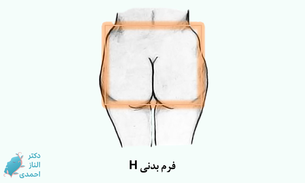 فرم بدنی H