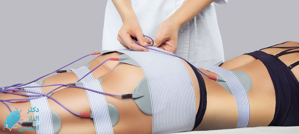 تحریک الکتریکی عضلات