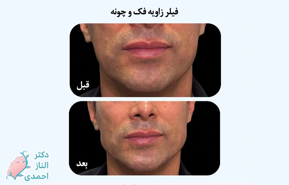 انتخاب متریال مناسب
