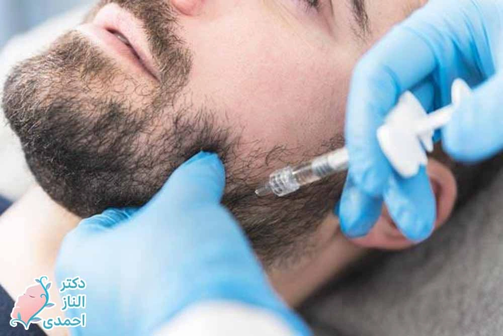 زاویهسازی فک و صورت مخصوص آقایان