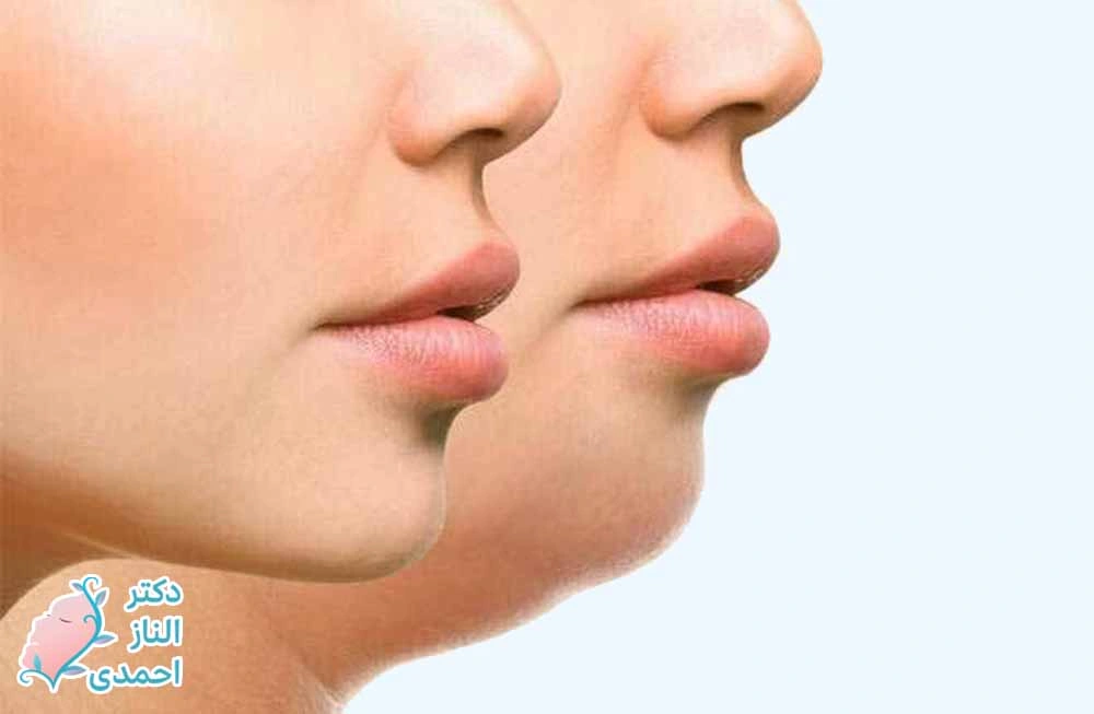 استراتژی