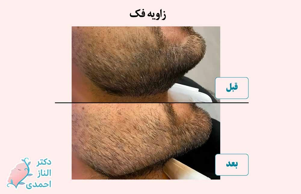 زاویه سازی مردانه