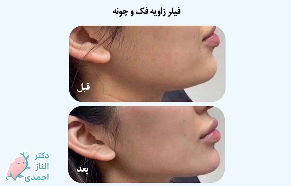زاویهسازی واقعی
