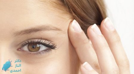 بوتاکس چشم گربه‌ای برای چهره من مناسب است ؟